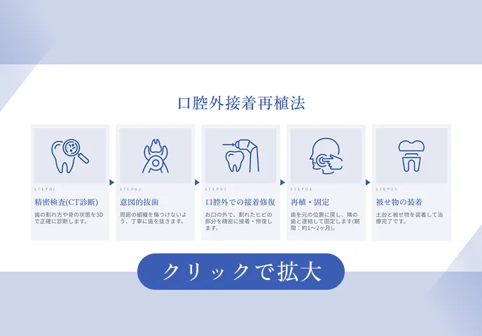 口腔外接着再植法の治療ステップ図解｜新橋ケイデンタルオフィス