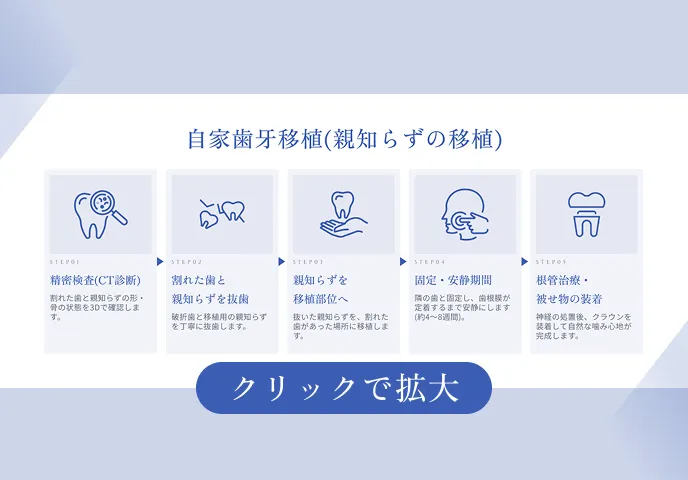 自家歯牙移植（親知らずの移植）の手順イラスト｜新橋ケイデンタルオフィス