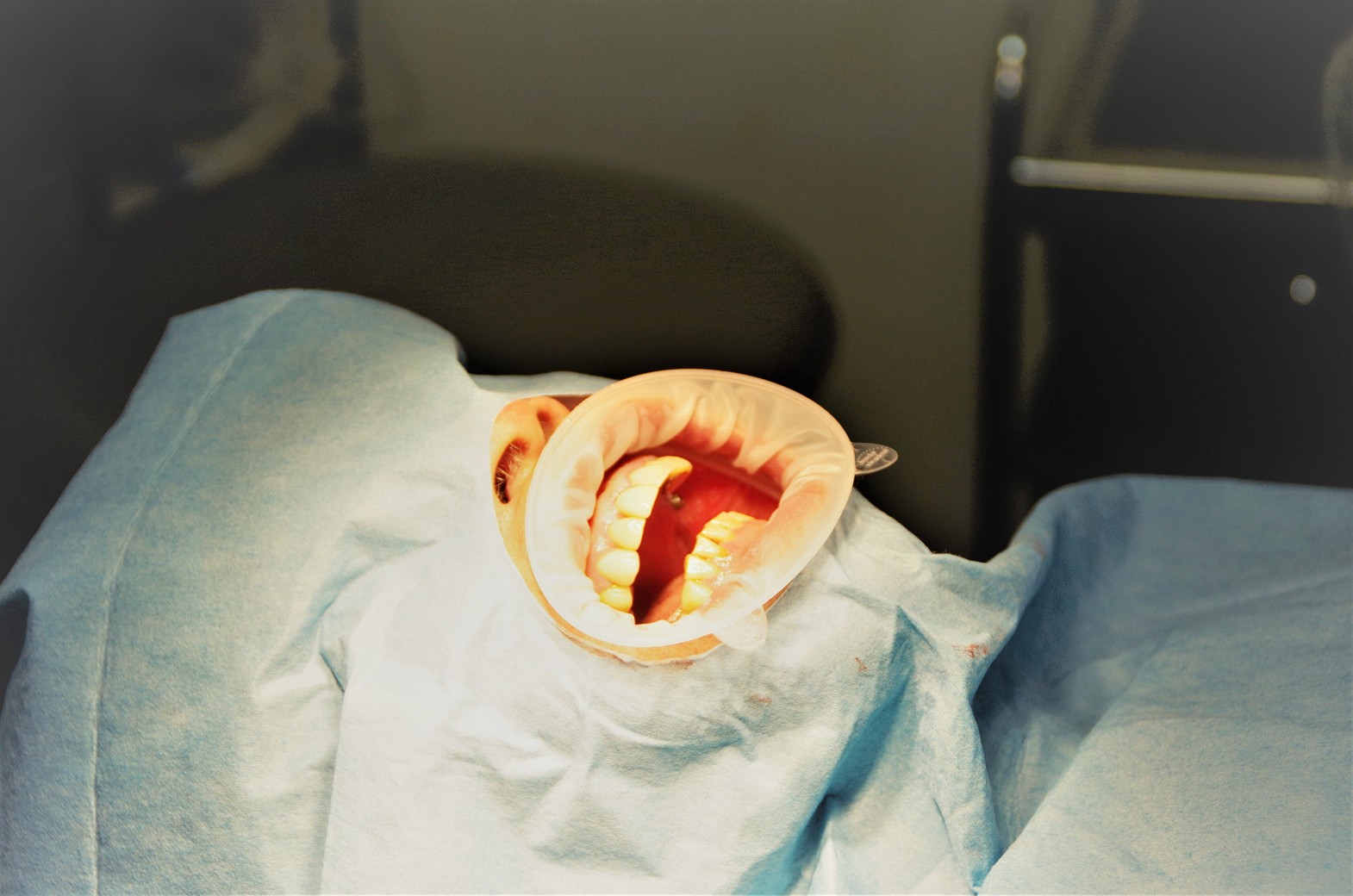 オプトラゲート