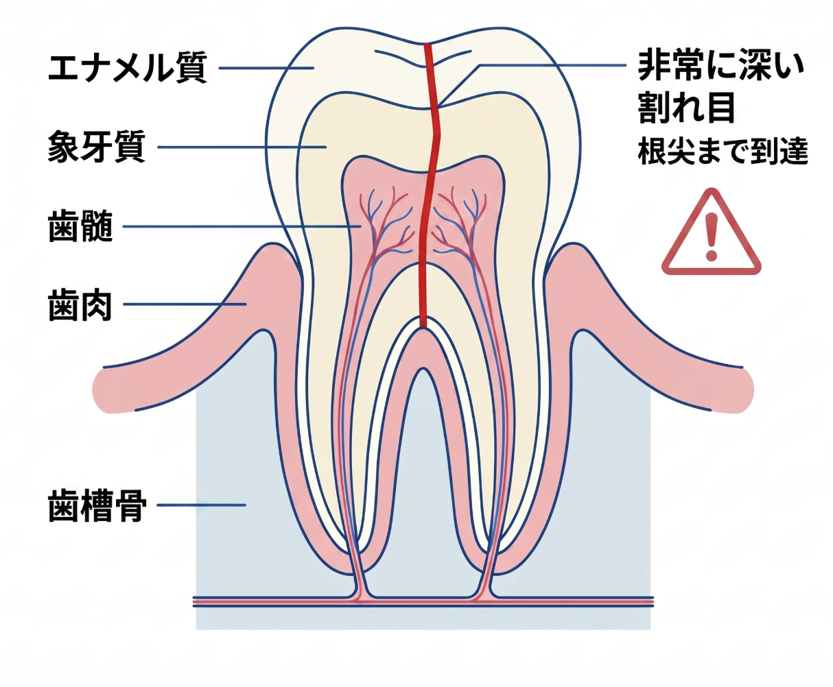 矯正的挺出＋土台＋クラウン